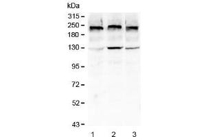 Western blot testing of human 1) HEK293T, 2) HeLa and 3) A549 cell lysate with Collagen IV antibody at 0.
