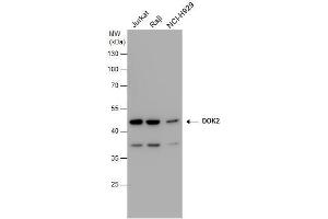 WB Image DOK2 antibody detects DOK2 protein by western blot analysis. (DOK2 anticorps)