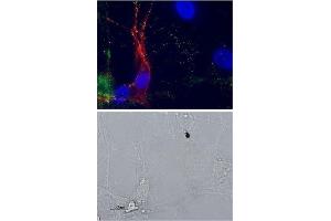 Multiplex staining of p75NTR and mGluR1 in rat DRGs - Cell surface detection of p75NTR and mGluR1 in intact live DRG neurons labeled with Anti-mGluR1 (extracellular) Antibody (ABIN7043245, ABIN7044330 and ABIN7044331), (1:100) followed by goat-anti-rabbit-AlexaFluor-488 secondary antibody (green). (NGFR anticorps  (Extracellular, Stalk Region) (Atto 550))