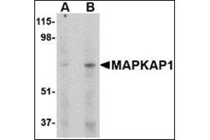 Western blot analysis of MAPKAP1 in human skeletal muscle tissue lysate with this product at (A) 1 and (B) 2 μg/ml. (Transportin 1 anticorps  (Center))