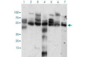 Western blot analysis of Lane 1: Hela cell lysate; Lane 2: K562 cell lysate; Lane 3: NIH/3T3 cell lysate; Lane 4: C6 cell lysate; Lane 5: MCF-7 cell lysate; Lane 6: Jurkat cell lysate; Lane 7: A431 cell lysate with CCNE1 monoclonal antibody, clone 5F8C5  at 1:500-1:2000 dilution. (Cyclin E1 anticorps  (AA 307-410))