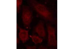 Immunofluorescence staining of methanol-fixed HeLa cells using Phospho-DOK2-Y299 antibody (ABIN2987731). (DOK2 anticorps  (pTyr299))