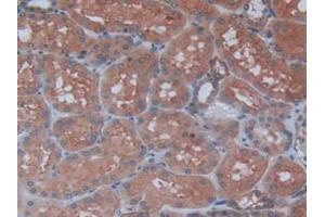 Figure. (AGLU anticorps  (AA 213-392))