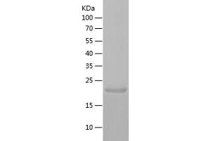 Western Blotting (WB) image for Reticulon 1 (RTN1) (AA 1-172) protein (His tag) (ABIN7124836)