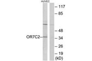 Western blot analysis of extracts from HuvEc cells, using OR7C2 Antibody. (OR7C2 anticorps  (AA 198-247))