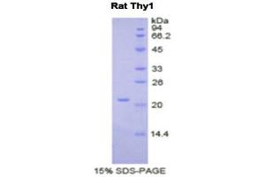 SDS-PAGE (SDS) image for CD90 (THY1) (AA 1-161) protein (His tag) (ABIN1821661)