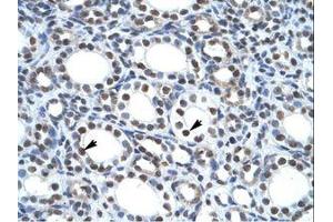 Image no. 1 for anti-tyrosyl-DNA phosphodiesterase 2 (TDP2) (AA 154-203) antibody (ABIN6735942)