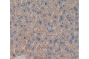Used in DAB staining on fromalin fixed paraffin- embedded liver tissue (AGXT anticorps  (AA 120-334))