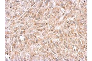 IHC-P Image Chromogranin C antibody detects SCG2 protein at cytosol on U87 xenograft by immunohistochemical analysis. (SCG2 anticorps)