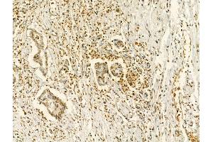 ABIN6256069 and ABIN6267241 at 1/100 staining Human normal tissues adjacent to liver cancer by IHC-P.