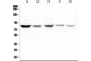 Western blot analysis of NOX5 using anti-NOX5 antibody (ABIN6719638).