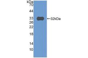 Western blot analysis of recombinant Human C9. (C9 anticorps  (AA 22-265))