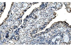 IHC analysis of DLX2 using anti-DLX2 antibody (ABIN7599936). (DLX2 anticorps  (AA 13-310))