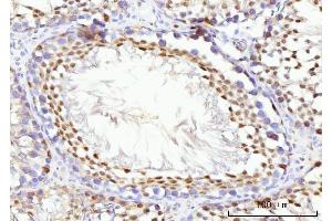 IHC analysis of KIFC1 using anti-KIFC1 antibody (ABIN7599523). (KIFC1 anticorps  (AA 1-673))