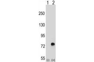 Western blot analysis of TGFBI antibody and 293 cell lysate either nontransfected (Lane 1) or transiently transfected (2) with the TGFBI gene. (TGFBI anticorps  (AA 106-135))