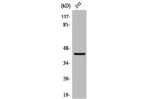 Western Blot analysis of HepG2 cells using CBX6 Polyclonal Antibody (CBX6 anticorps  (N-Term))