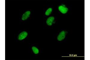Immunofluorescence of  purified  MaxPab antibody to ZFP1 on HeLa cell. (Zfp-1 anticorps  (AA 1-352))