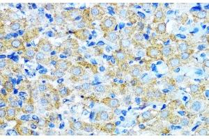 Immunohistochemistry of paraffin-embedded Rat ovary using Aromatase Polyclonal Antibody at dilution of 1:100 (40x lens). (Aromatase anticorps)
