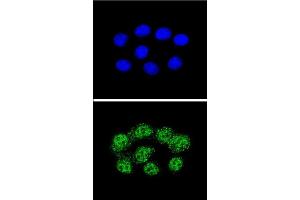Confocal immunofluorescent analysis of MSH2 Antibody (Center) (ABIN655517 and ABIN2845032) with Hela cell followed by Alexa Fluor® 488-conjugated goat anti-rabbit lgG (green). (MSH2 anticorps  (AA 637-665))
