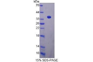 SDS-PAGE (SDS) image for Calcineurin Binding Protein 1 (CABIN1) (AA 11-289) protein (His tag) (ABIN6238858)