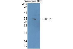 Detection of Recombinant COL9a1, Rat using Polyclonal Antibody to Collagen Type IX Alpha 1 (COL9a1)