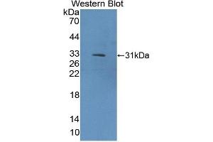 Detection of Recombinant COL9a1, Rat using Polyclonal Antibody to Collagen Type IX Alpha 1 (COL9a1) (COL9A1 anticorps  (AA 24-268))