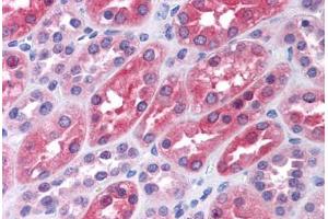 Human Kidney: Formalin-Fixed, Paraffin-Embedded (FFPE) (LMTK2 anticorps  (AA 1181-1280))