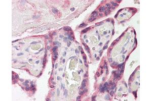 Anti-ESYT1 antibody IHC of human placenta. (ESYT1 anticorps  (AA 1038-1050))