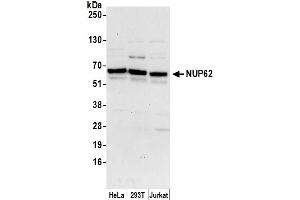 Western Blotting (WB) image for anti-Nucleoporin 62kDa (NUP62) (AA 75-125) antibody (ABIN7450509)