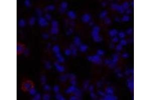 Immunofluorescence analysis of Rat lung tissue using TGFB1 Polyclonal Antibody at dilution of 1:200. (TGFB1 anticorps)