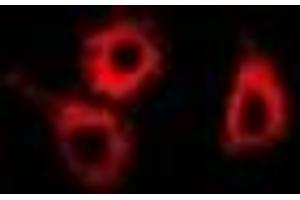 Immunofluorescent analysis of SMYD4 staining in MCF7 cells. (SMYD4 anticorps)