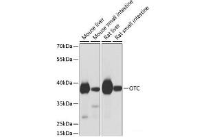 Western blot analysis of extracts of various cell lines using OTC Polyclonal Antibody at dilution of 1:1000. (OTC anticorps)