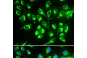Immunofluorescence analysis of MCF-7 cells using SLC22A5 Polyclonal Antibody (SLC22A5 anticorps)