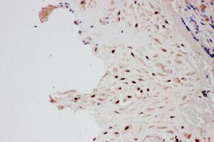 Anti-PIAS1 antibody, IHC(P) IHC(P): Human Placenta Tissue