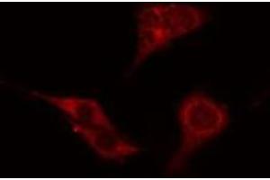 ABIN6276528 staining Hela cells by IF/ICC. (ATG4C anticorps  (N-Term))