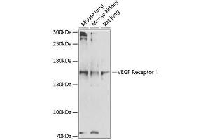 Western blot analysis of VEGFR1 expression using ABIN6140687 (FLT1 anticorps  (AA 20-300))