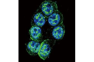 Confocal immunofluorescent analysis of Phospho-K1-p Antibody (ABIN389799 and ABIN2839695) with Hela cell followed by Alexa Fluor 488-conjugated goat anti-rabbit lgG (green).