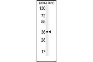 Western blot analysis of OR4A47 Antibody (C-term) in NCI-H460 cell line lysates (35ug/lane).