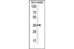Western blot analysis of OR4A47 Antibody (C-term) in NCI-H460 cell line lysates (35ug/lane).