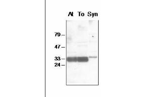 Western blot analysis of chloroplast (Arabidopsis and tobacco) and Synechocystis thylakoid proteins with anti-PsbA-Nt (D1-Nt anticorps)
