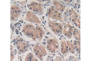 Used in DAB staining on fromalin fixed paraffin- embedded stomach tissue (ABCF1 anticorps  (AA 625-845))