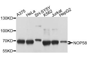 Western blot analysis of extracts of various cell lines, using NOP58 antibody. (NOP58 anticorps  (AA 360-529))