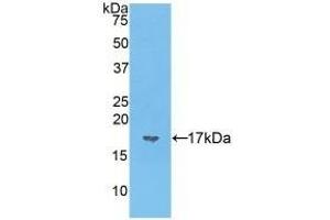 Detection of Recombinant VIP, Mouse using Polyclonal Antibody to Vasoactive Intestinal Peptide (VIP)