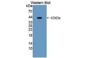 Detection of Recombinant GP73, Human using Polyclonal Antibody to Golgi Phosphoprotein 2 (GOLPH2) (GOLM1 anticorps  (AA 119-223))