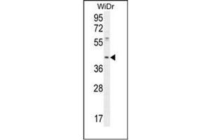 Western blot analysis of DUS4L Antibody  in WiDr cell line lysates (35ug/lane).