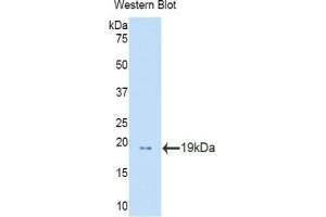 Detection of Recombinant PFN1, Human using Polyclonal Antibody to Profilin 1 (PFN1)