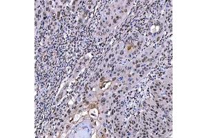 IHC analysis of SAE1 using anti-SAE1 antibody (ABIN7601346). (SAE1 anticorps  (AA 33-299))