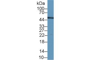 Detection of LRG1 in Human Serum using Monoclonal Antibody to Leucine Rich Alpha-2-Glycoprotein 1 (LRG1) (LRG1 anticorps  (AA 37-340))