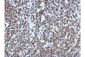 IHC-P Image Immunohistochemical analysis of paraffin-embedded 59T xenograft, using MDC1, antibody at 1:500 dilution. (MDC1 anticorps)