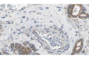 ABIN6275049 at 1/100 staining Human prostate tissue by IHC-P. (AGBL2 anticorps  (C-Term))